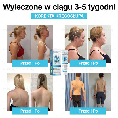 𝗔𝗲𝗲𝗵𝗳𝗲𝗻𝗴™ Krem Naprawczy Stawów z Kwasem Hialuronowym👩‍⚕️（Dokładne leczenie zapalenia stawów, neuralgii, bólu mięśniowego）