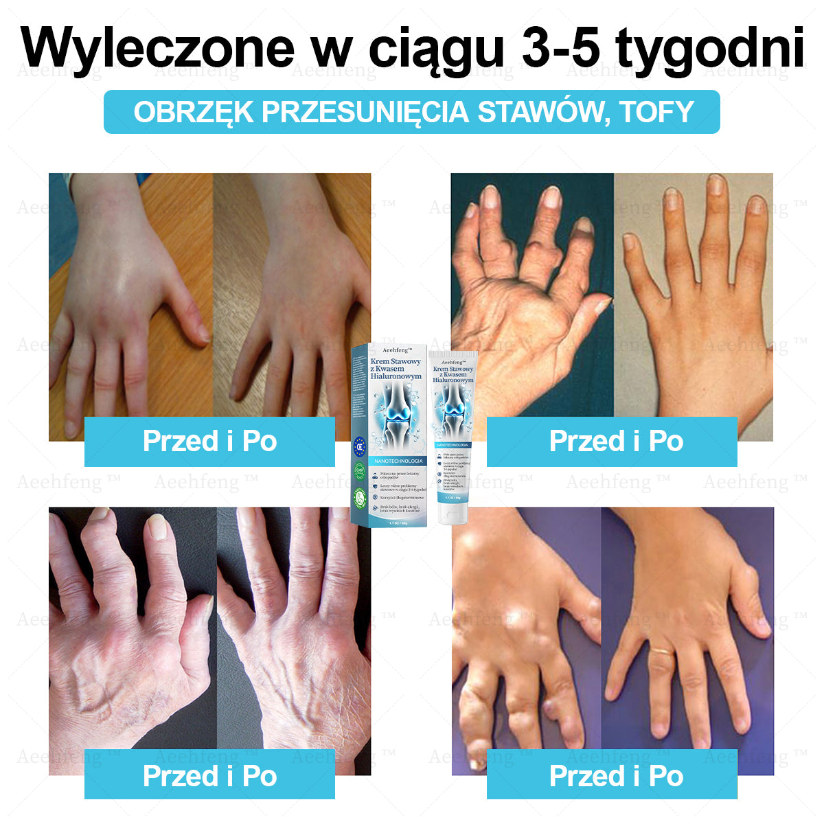 𝗔𝗲𝗲𝗵𝗳𝗲𝗻𝗴™ Krem Naprawczy Stawów z Kwasem Hialuronowym👩‍⚕️（Dokładne leczenie zapalenia stawów, neuralgii, bólu mięśniowego）