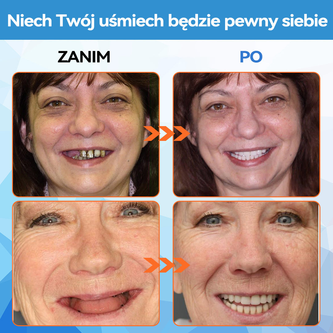 【Płatność przy odbiorze】𝐁𝐢𝐤𝐞𝐧𝐝𝐚™ 💡 Zestaw silikonowej protezy przewodowej (🦷 Ograniczony czasowo rabat) Oferta trwa 30 minut 🔥)