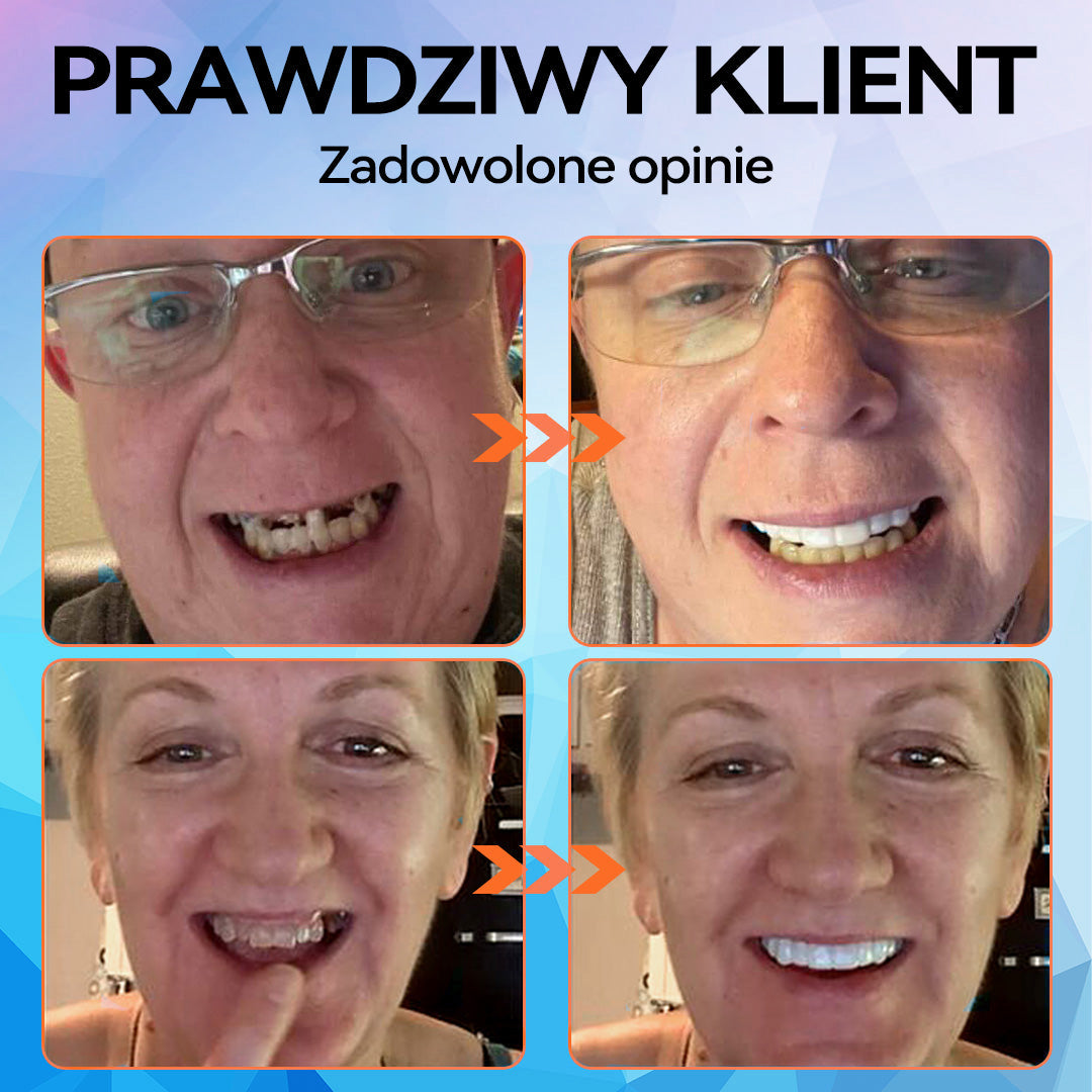 【Płatność przy odbiorze】𝐁𝐢𝐤𝐞𝐧𝐝𝐚™ 💡 Zestaw silikonowej protezy przewodowej (🦷 Ograniczony czasowo rabat) Oferta trwa 30 minut 🔥)